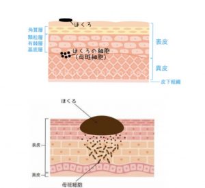 シミとほくろの違い Dr Recella認定サロン ミベル フェイシャルサロン 高崎市旭町のエステサロン